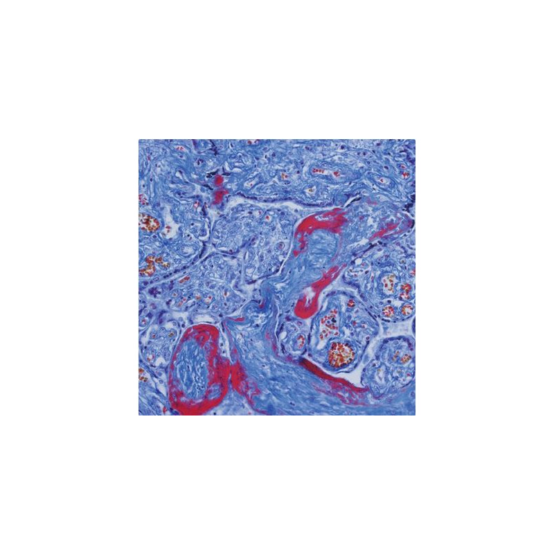 Evident Olympus Microscopio CX41 Pathology, ergo bino, hal,  40x,100x, 400x