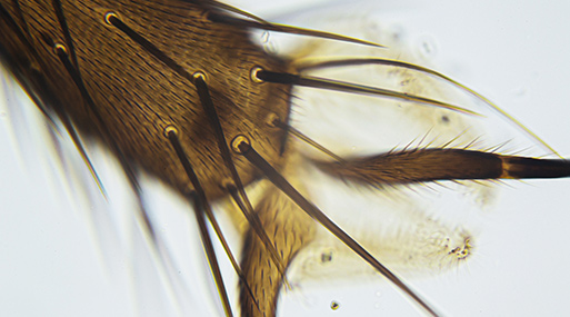 Análisis de parásitos