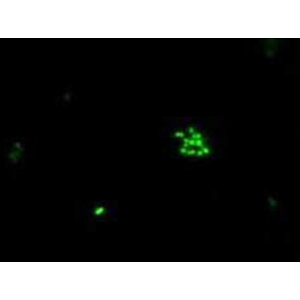 Hund Microscopio H 600 Wilo-Brau, bino, 100x - 630x