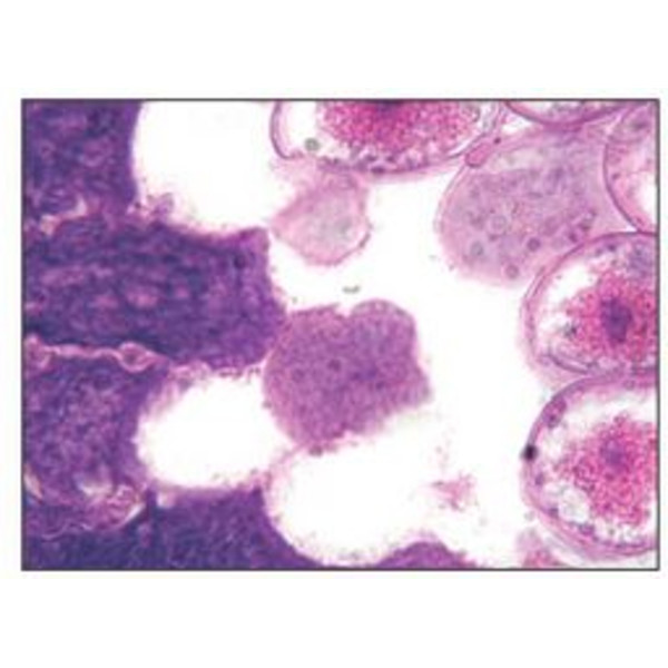 Optika Microscopio achro, bino, 400x, LED, B-50B