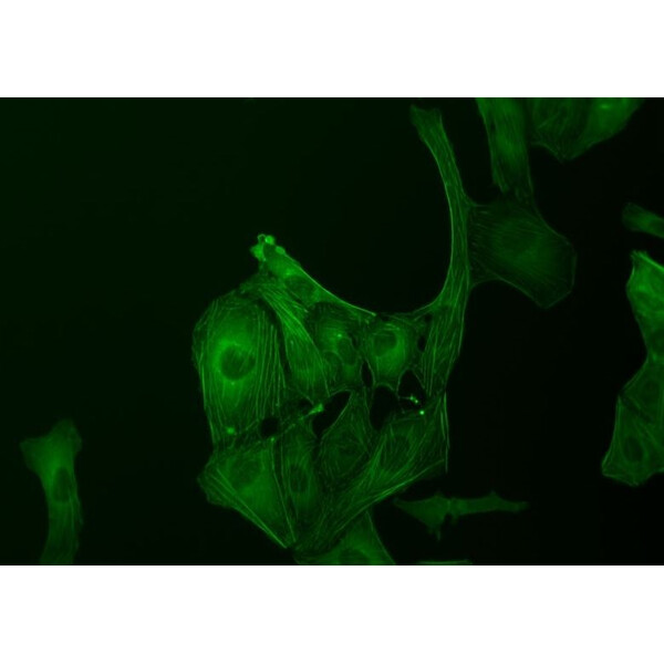 ZEISS Microscopio invertido Primovert trino PH1, 40x-400x