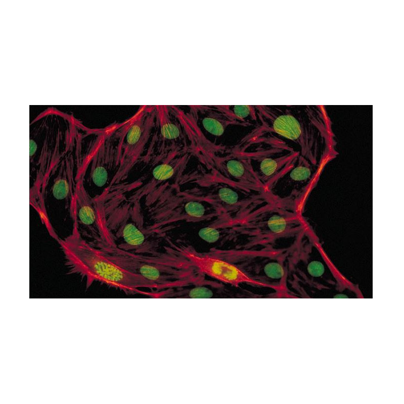 Evident Olympus Microscopio CX41 Fluorescencia, trino, Hal, 40x,100x, 400x