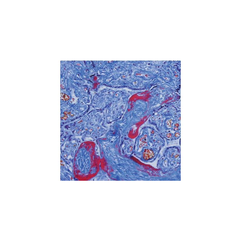 Evident Olympus Microscopio CX41 Patología, trino, Hal, 40x,100x, 400x