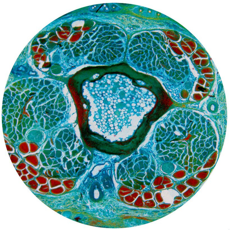 Optika Microscopio B-510BFIVD, trino, W-PLAN IOS, 40x-1000x, DIV