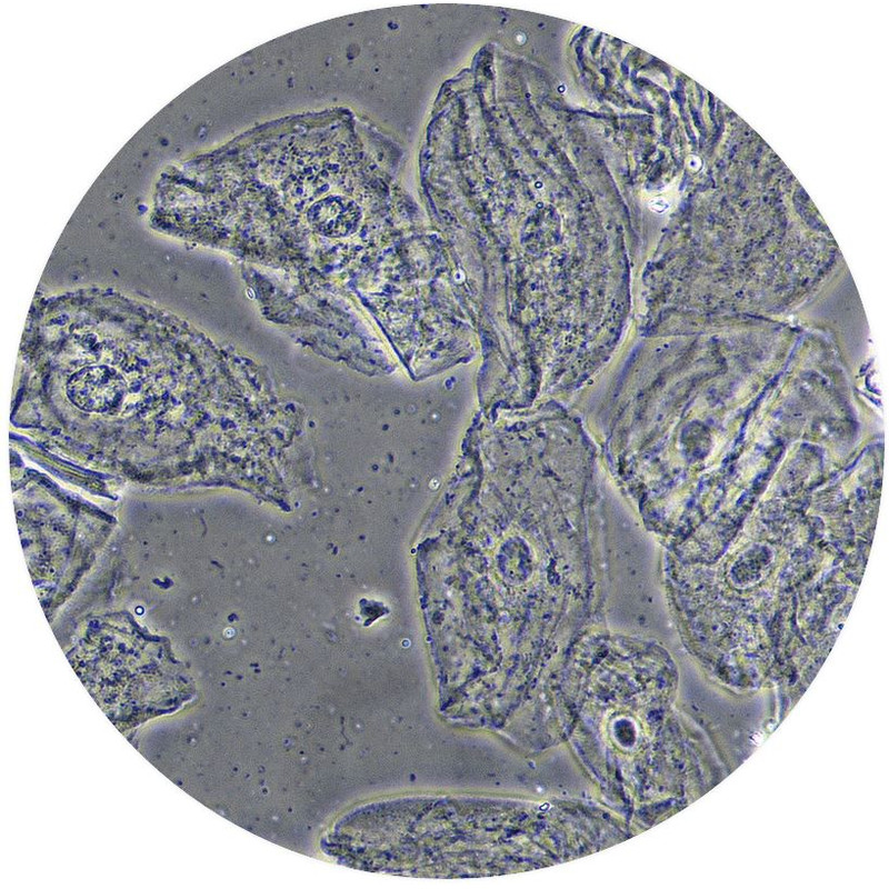Optika Microscopio B-510PHIVD, trino, fase, W-PLAN, IOS, 40x-1000x, EU, IVD