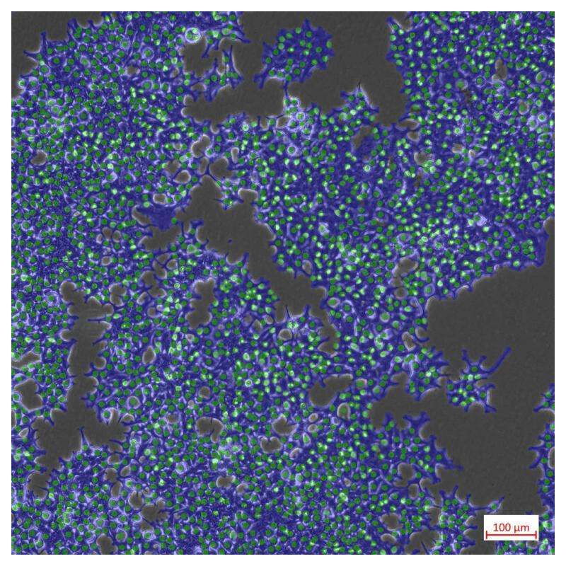 ZEISS Microscopio Axiovert 5 Digital, PH, FL, 50-400x, Ph1, 0,4 NA, LED, 5 MP, color
