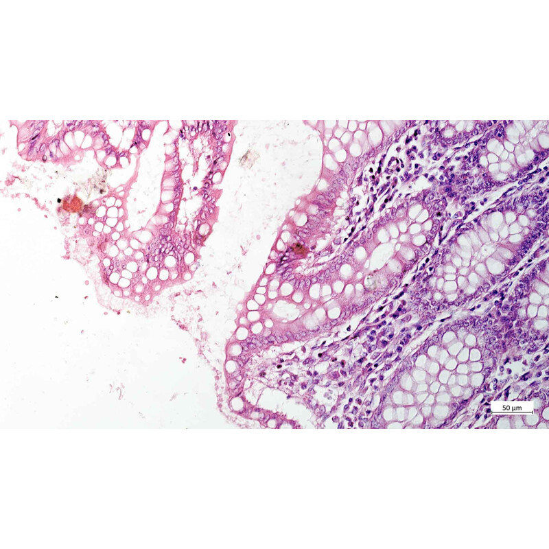ZEISS Microscopio Axiovert 5 Digital, PH, FL, 50-400x, Ph1, 0,4 NA, LED, 5 MP, color