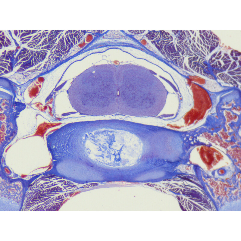 ZEISS Microscopio stereo zoom Stemi 355, C Edu, trino, w.d. 110 mm, 10x/23, 5,5:1 , 7,2x-40x, AL/DL, Spot C LED